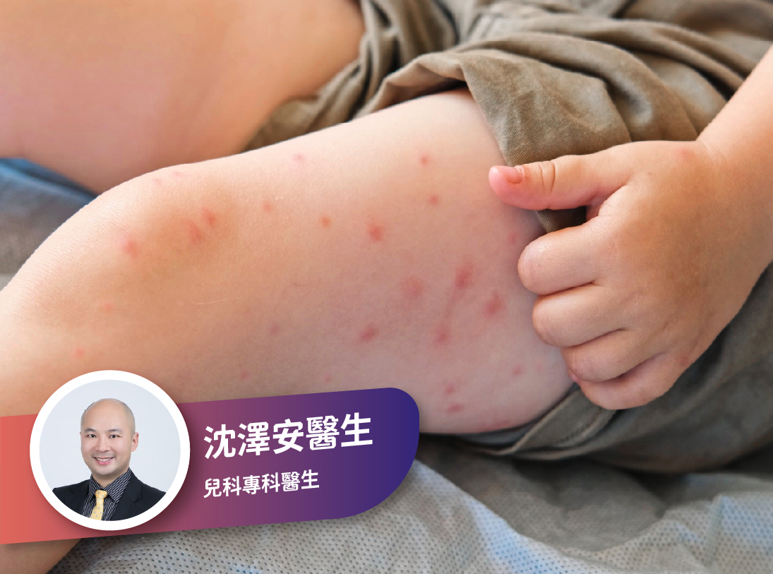 小兒外科專科沈澤安醫生-兒童麻疹